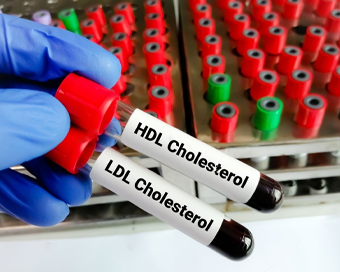 Instant Cholesterol Test
